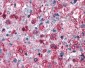 CRHR2 / CRF2 Receptor Antibody (N-Terminus)
